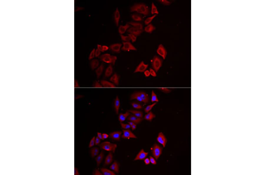 Immunofluorescence - Anti-PINCH 1 Antibody (A15201) - Antibodies.com