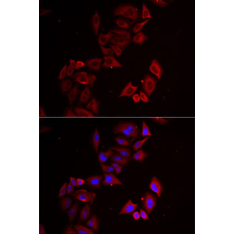 Immunofluorescence - Anti-PINCH 1 Antibody (A15201) - Antibodies.com