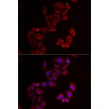 Immunofluorescence - Anti-PINCH 1 Antibody (A15201) - Antibodies.com
