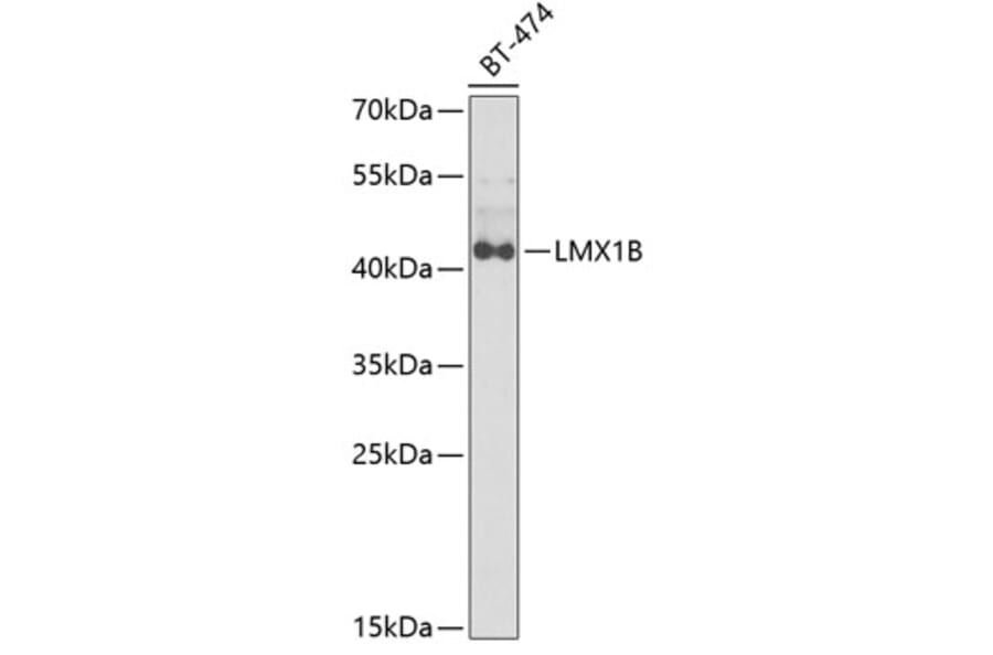 Western Blot - Anti-LMX1B Antibody (A6386) - Antibodies.com