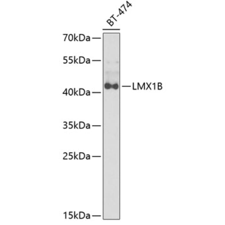 Western Blot - Anti-LMX1B Antibody (A6386) - Antibodies.com