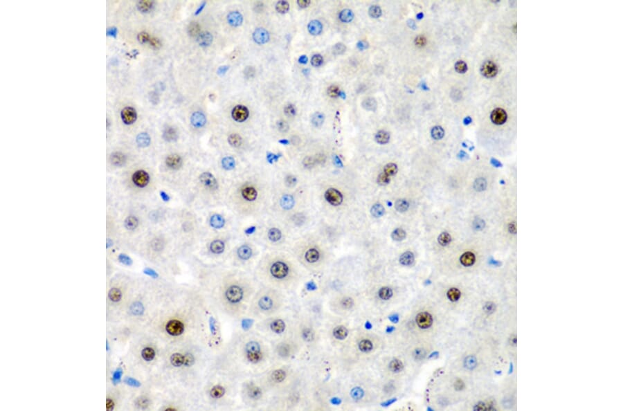 Immunohistochemistry - Anti-LMX1B Antibody (A6386) - Antibodies.com