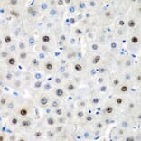 Immunohistochemistry - Anti-LMX1B Antibody (A6386) - Antibodies.com