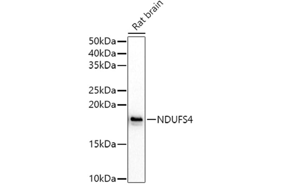 Western Blot - Anti-Ndufs4 Antibody (A15203) - Antibodies.com