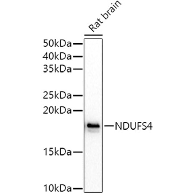 Western Blot - Anti-Ndufs4 Antibody (A15203) - Antibodies.com