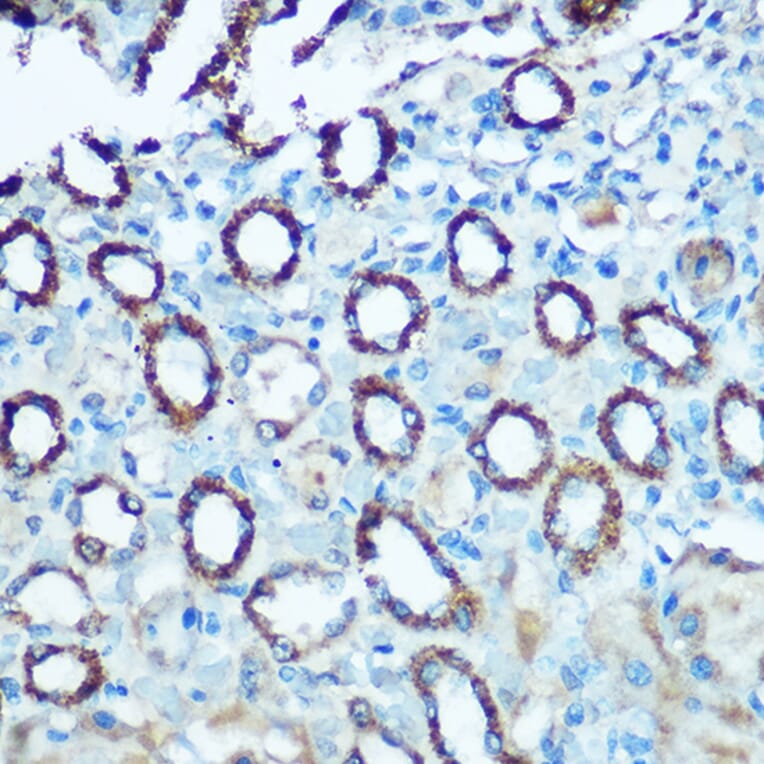 Immunohistochemistry - Anti-Ndufs4 Antibody (A15203) - Antibodies.com