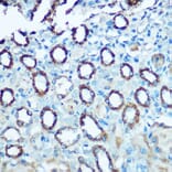 Immunohistochemistry - Anti-Ndufs4 Antibody (A15203) - Antibodies.com