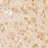 Immunohistochemistry - Anti-OGDH Antibody (A15204) - Antibodies.com