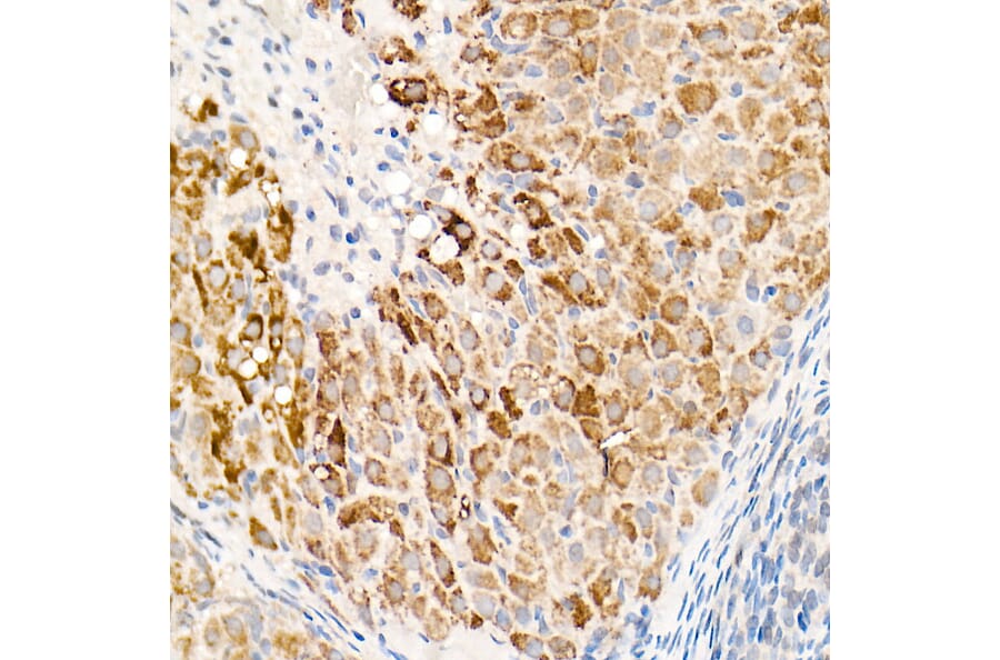 Immunohistochemistry - Anti-OGDH Antibody (A15204) - Antibodies.com