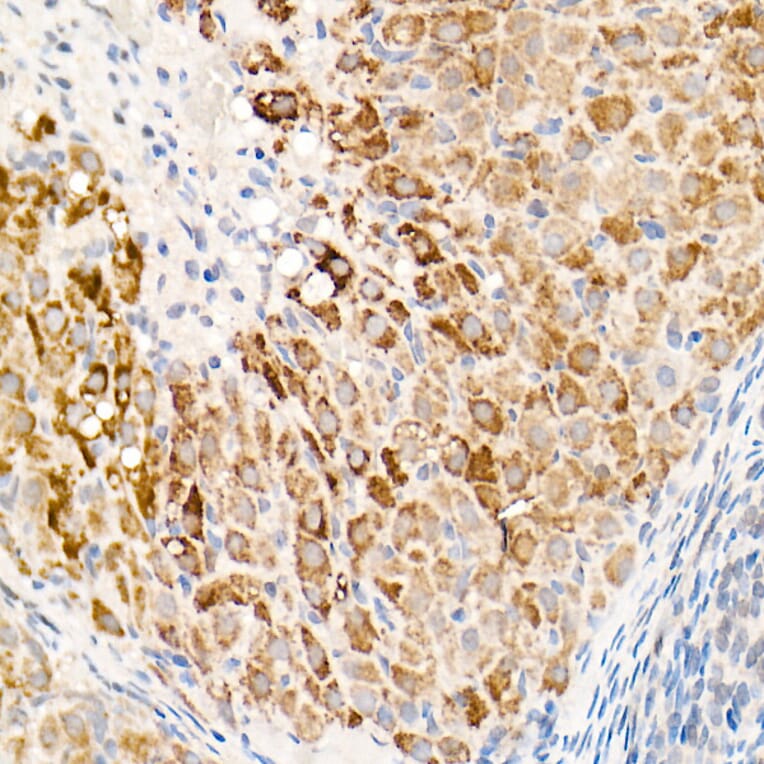 Immunohistochemistry - Anti-OGDH Antibody (A15204) - Antibodies.com