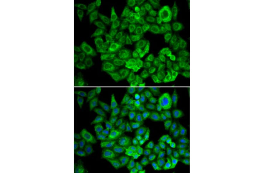 Immunofluorescence - Anti-OGDH Antibody (A15204) - Antibodies.com