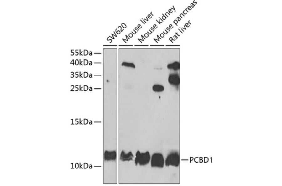 Western Blot - Anti-PCBD1 Antibody (A15205) - Antibodies.com