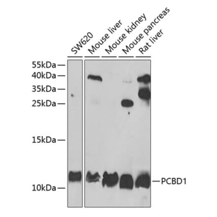 Western Blot - Anti-PCBD1 Antibody (A15205) - Antibodies.com