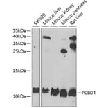 Western Blot - Anti-PCBD1 Antibody (A15205) - Antibodies.com