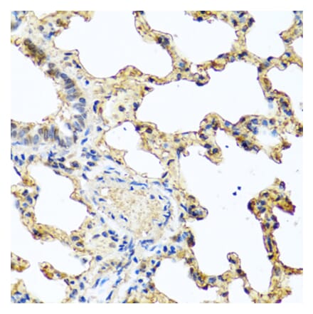 Immunohistochemistry - Anti-GCDFP 15 Antibody (A15206) - Antibodies.com