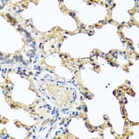 Immunohistochemistry - Anti-GCDFP 15 Antibody (A15206) - Antibodies.com