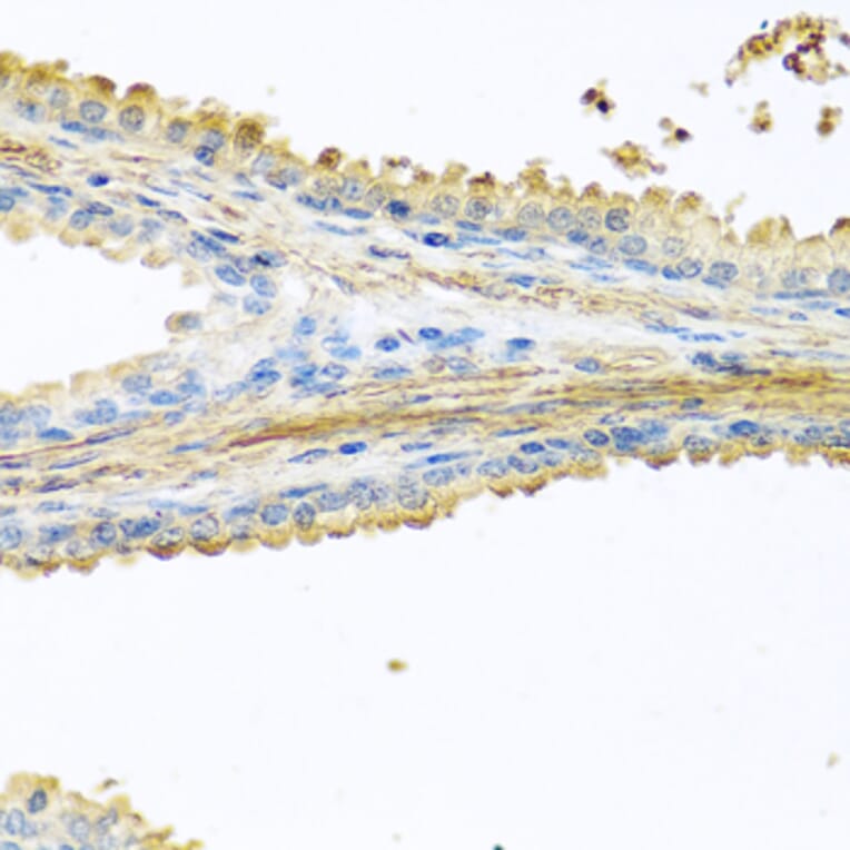 Immunohistochemistry - Anti-GCDFP 15 Antibody (A15206) - Antibodies.com