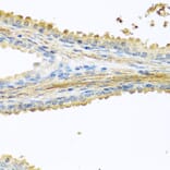 Immunohistochemistry - Anti-GCDFP 15 Antibody (A15206) - Antibodies.com