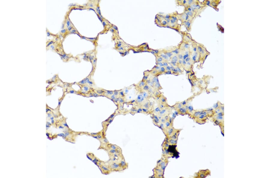Immunohistochemistry - Anti-GCDFP 15 Antibody (A15206) - Antibodies.com