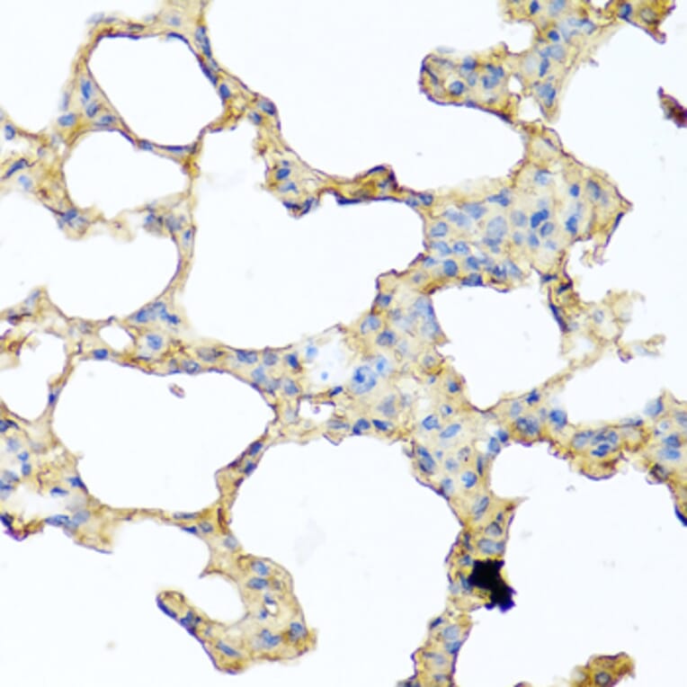 Immunohistochemistry - Anti-GCDFP 15 Antibody (A15206) - Antibodies.com