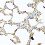 Immunohistochemistry - Anti-GCDFP 15 Antibody (A15206) - Antibodies.com