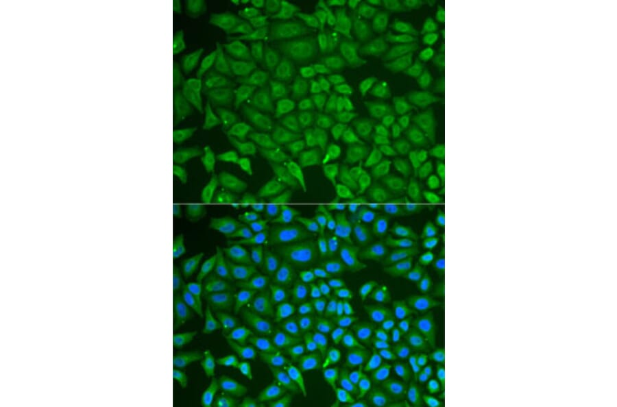 Immunofluorescence - Anti-GCDFP 15 Antibody (A15206) - Antibodies.com