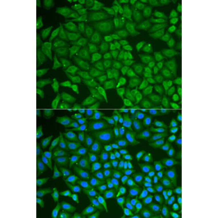 Immunofluorescence - Anti-GCDFP 15 Antibody (A15206) - Antibodies.com