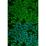 Immunofluorescence - Anti-GCDFP 15 Antibody (A15206) - Antibodies.com