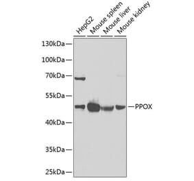 Western Blot - Anti-PPOX Antibody (A15208) - Antibodies.com
