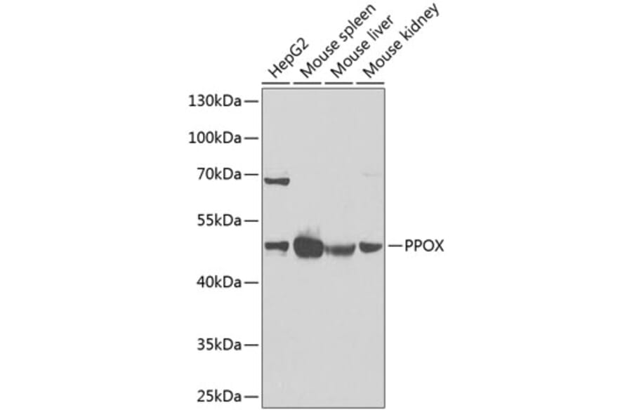 Western Blot - Anti-PPOX Antibody (A15208) - Antibodies.com