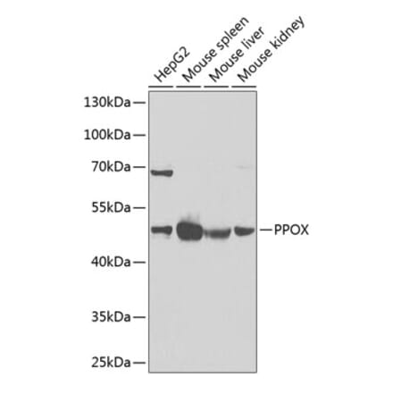 Western Blot - Anti-PPOX Antibody (A15208) - Antibodies.com