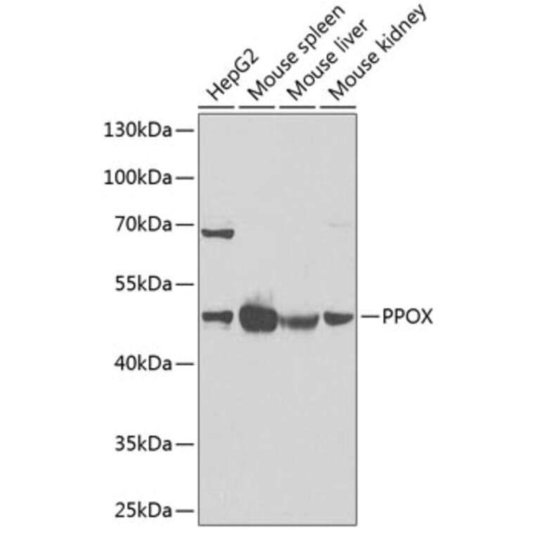 Western Blot - Anti-PPOX Antibody (A15208) - Antibodies.com