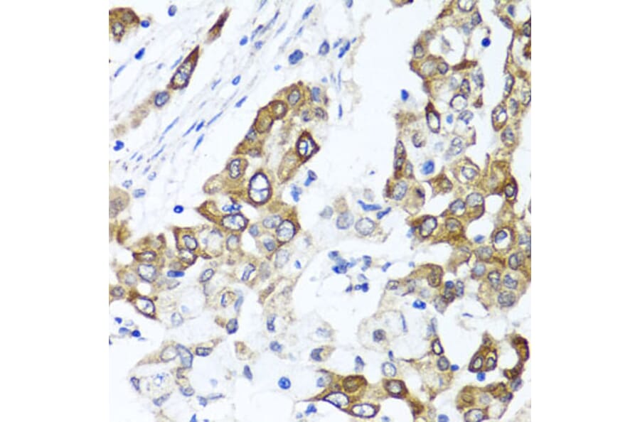 Immunohistochemistry - Anti-PPOX Antibody (A15208) - Antibodies.com