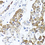 Immunohistochemistry - Anti-PPOX Antibody (A15208) - Antibodies.com
