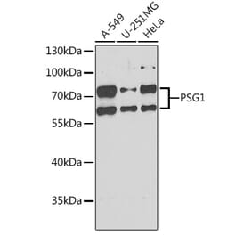 Western Blot - Anti-PSG1 Antibody (A15209) - Antibodies.com