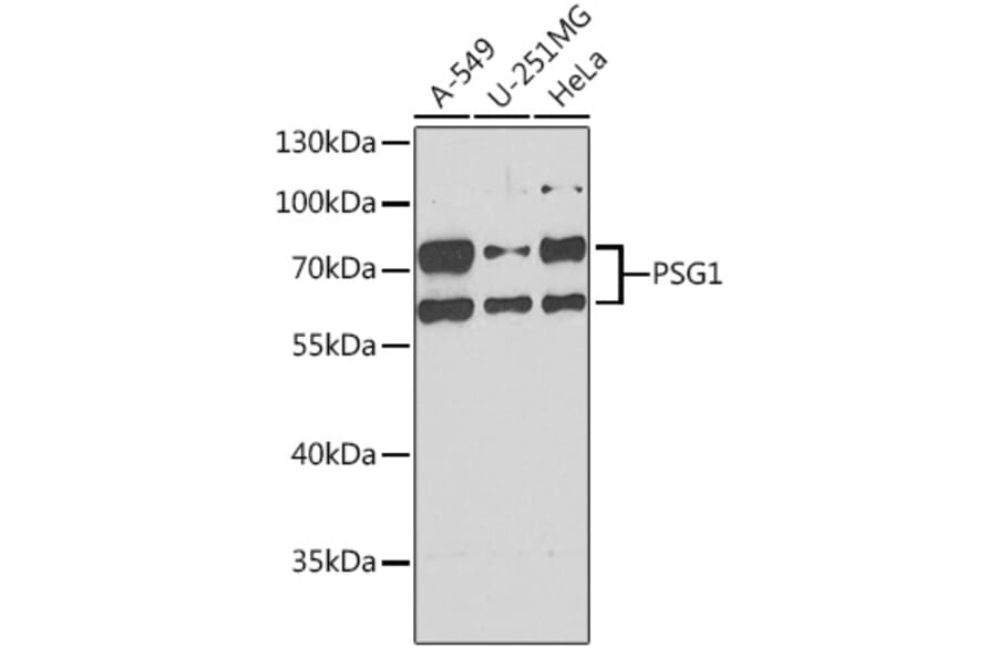 Western Blot - Anti-PSG1 Antibody (A15209) - Antibodies.com