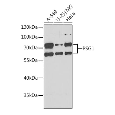 Western Blot - Anti-PSG1 Antibody (A15209) - Antibodies.com