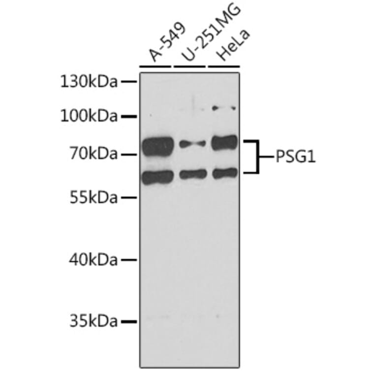 Western Blot - Anti-PSG1 Antibody (A15209) - Antibodies.com