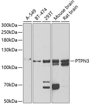 Western blot analysis of extracts of various cell lines, using Anti-PTPN3 Antibody (A6400) at 1:1,000 dilution.
Secondary antibody: Goat Anti-Rabbit IgG (H+L) (HRP) (AS014) at 1:10,000 dilution.
Lysates / proteins: 25µg per lane.
Blocking buffer: 3% non-fat dry milk in TBST.
Detection: ECL Enhanced Kit (RM00021).
Exposure time: 10s.