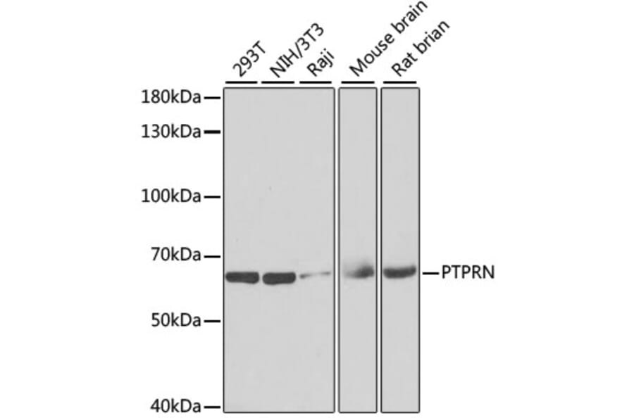 Western Blot - Anti-ICA 512/PTPRN Antibody (A15211) - Antibodies.com