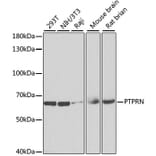 Western Blot - Anti-ICA 512/PTPRN Antibody (A15211) - Antibodies.com