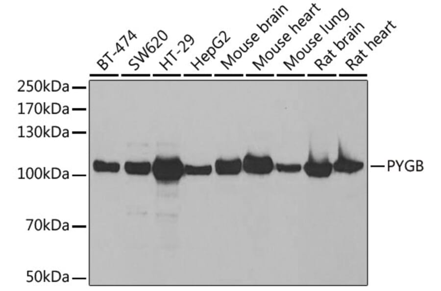 Western Blot - Anti-GPBB Antibody (A15212) - Antibodies.com