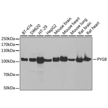 Western Blot - Anti-GPBB Antibody (A15212) - Antibodies.com