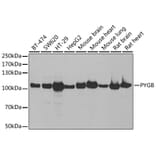 Western Blot - Anti-GPBB Antibody (A15212) - Antibodies.com