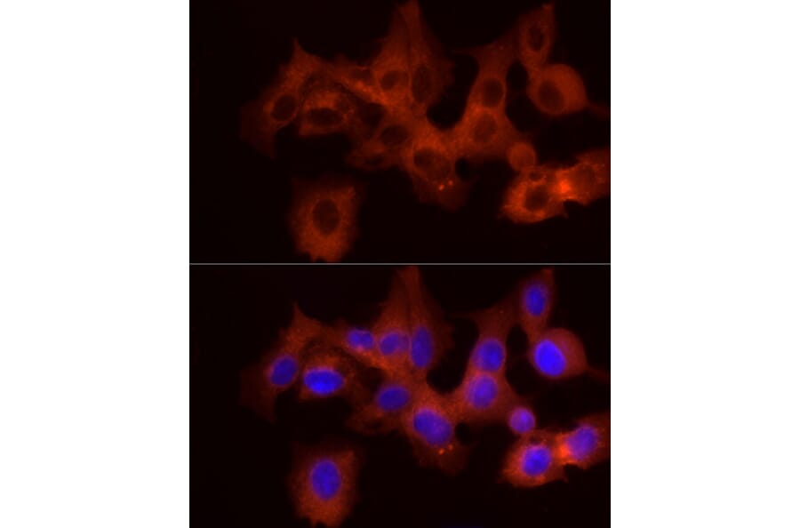 Immunofluorescence - Anti-GPBB Antibody (A15212) - Antibodies.com