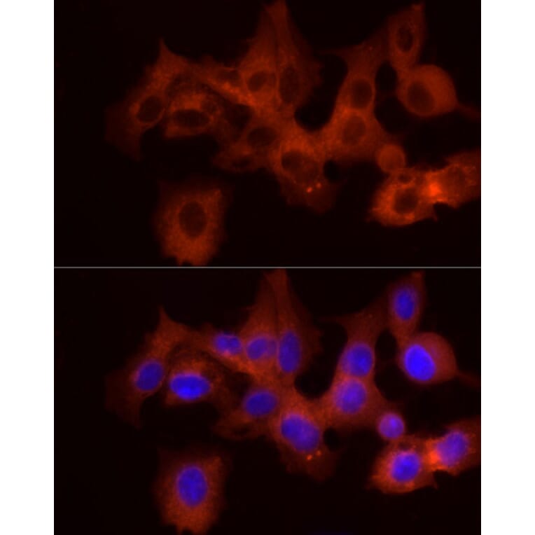 Immunofluorescence - Anti-GPBB Antibody (A15212) - Antibodies.com