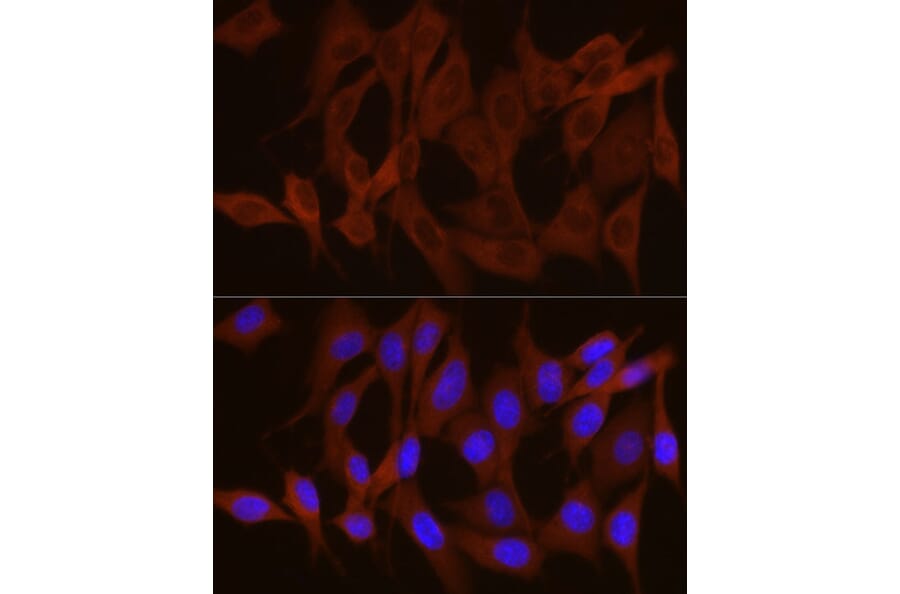 Immunofluorescence - Anti-GPBB Antibody (A15212) - Antibodies.com