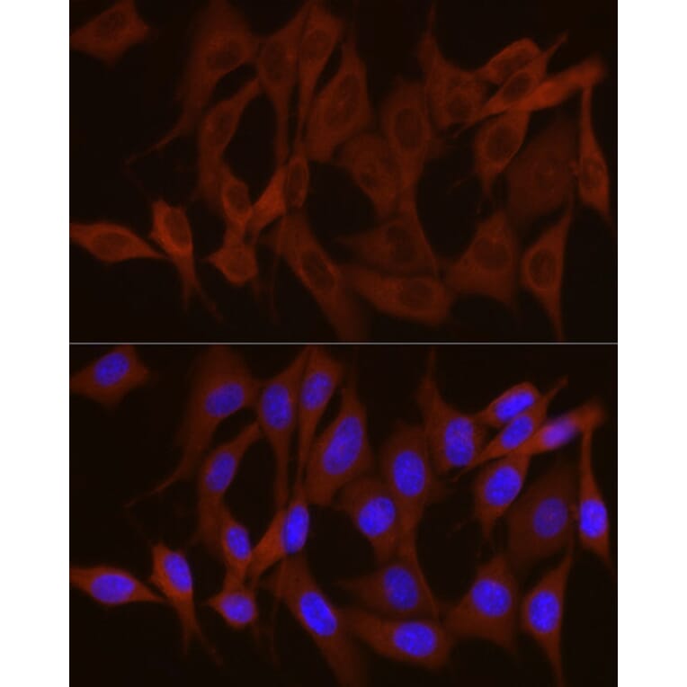 Immunofluorescence - Anti-GPBB Antibody (A15212) - Antibodies.com