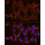 Immunofluorescence - Anti-GPBB Antibody (A15212) - Antibodies.com