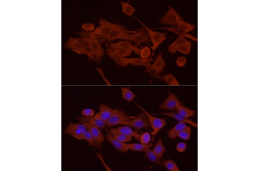 Immunofluorescence - Anti-GPBB Antibody (A15212) - Antibodies.com